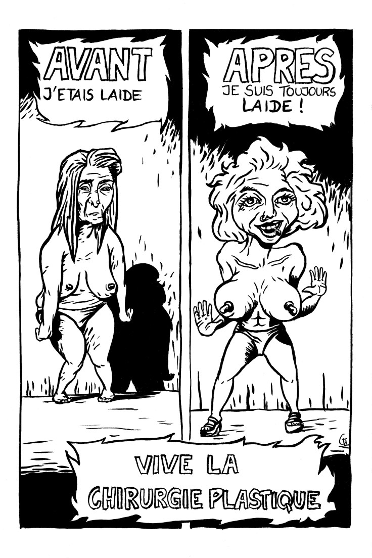 Vive la Chirurgie esthétique ! (illustration de Gilderic) Vive la Chirurgie esthétique ! (illustration de Gilderic)
